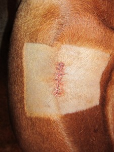 Axl's scar post lumpectomy
