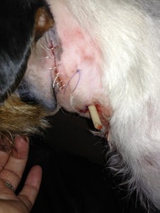 drain left in situ to a puncture wound and sutured laceration injury